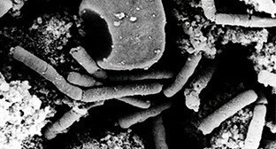 Бактерии сибирской язвы. Источник: http://ru.wikipedia.org